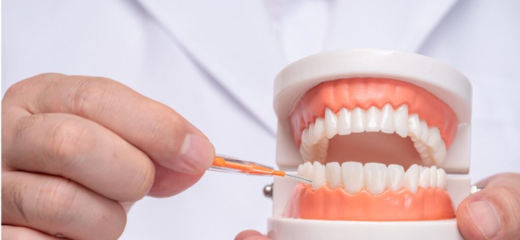 Gums Treatment & Cleaning Santa Rita Dental