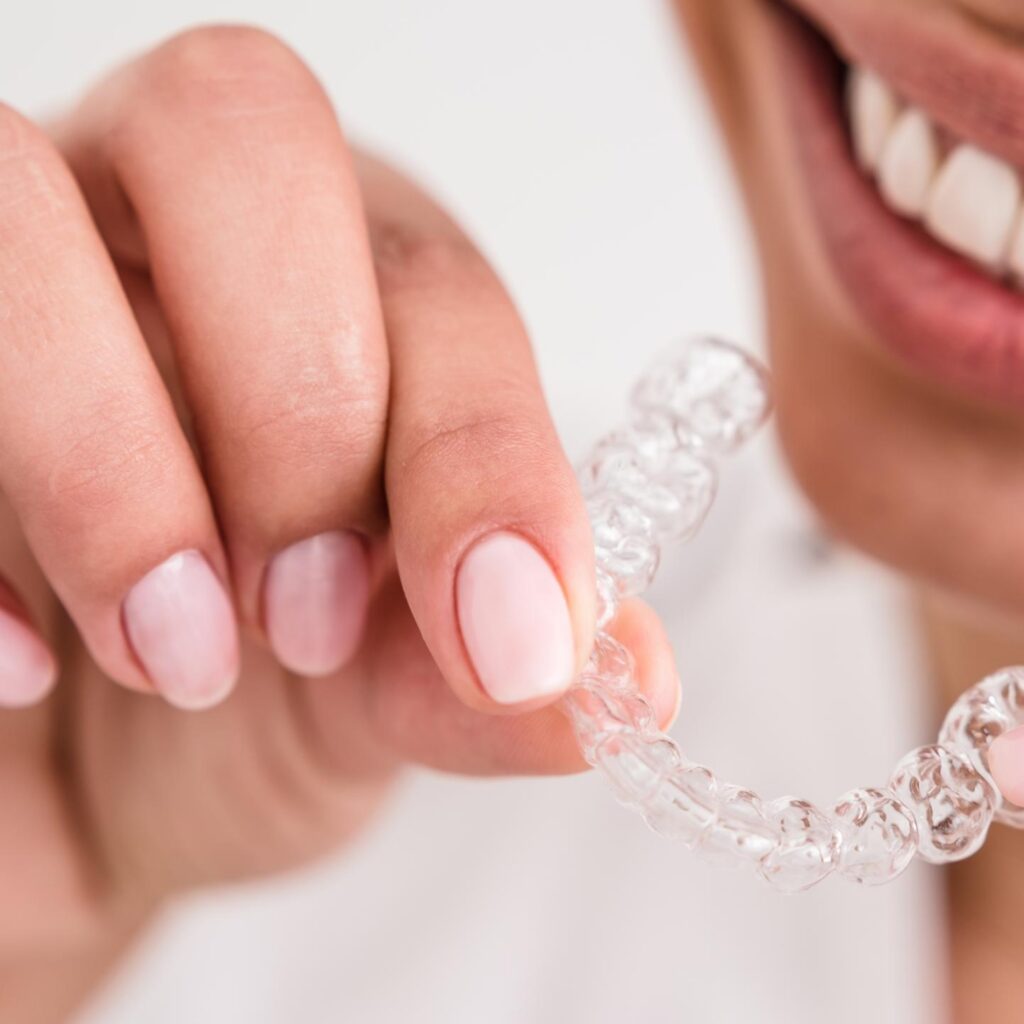 Invisalign Santa Rita Dental Bakersfield Invisalign Santa Rita Dental Bakersfield