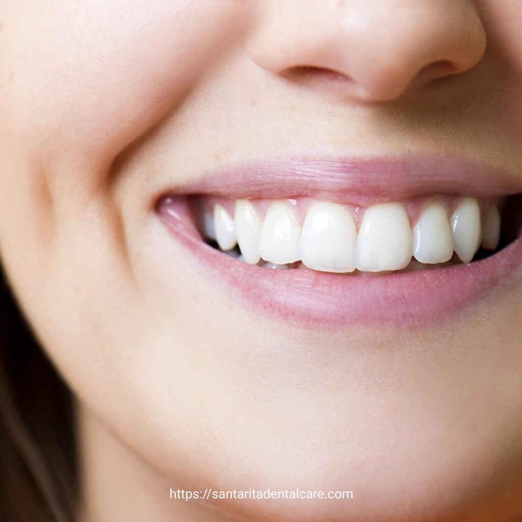 Santa Rita Dental Bakersfield implante dental Santa-Rita-Dental-Bakersfield-implante-dental