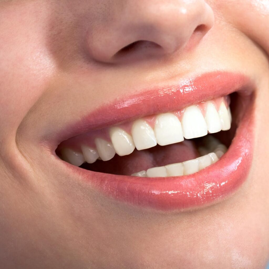 santa-rita-dental-dental-implant-bakersfield